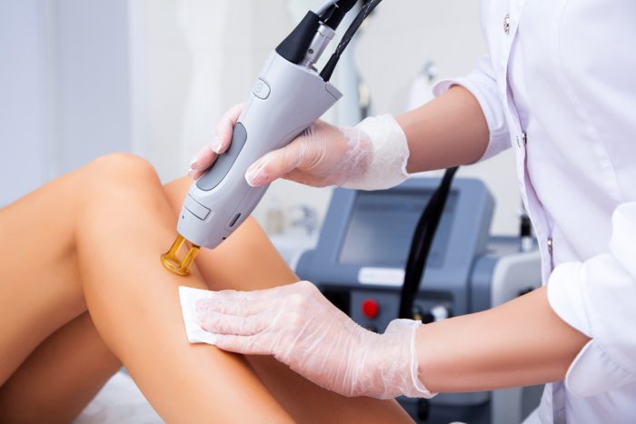 Woman getting Laser Hair Removal Treatment in Santee, CA by EC Medical Group