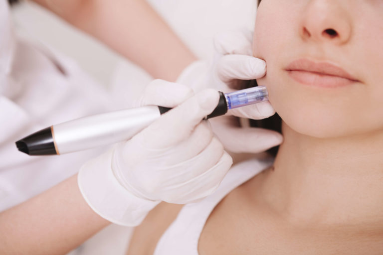 Dermapen Treatments