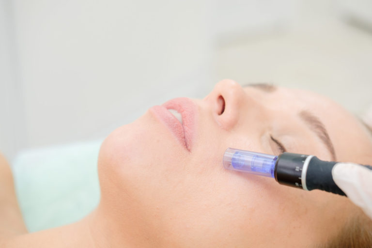 What is the Dermapen Treatment